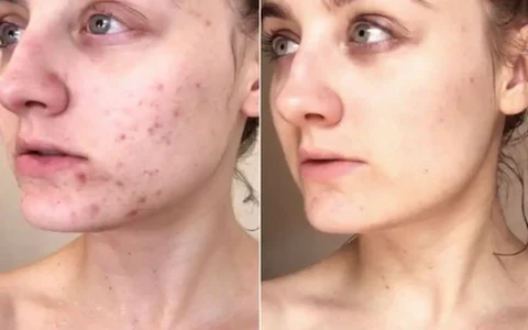 Antes e depois de Isabela, 39
