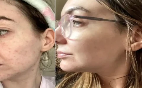 Antes e depois de Marina, 41