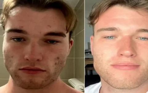 Antes e depois de André, 48