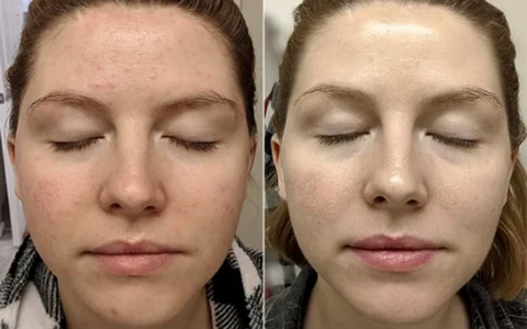 Antes e depois de Paula, 34