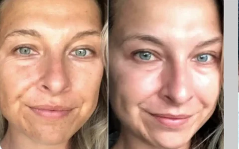 Antes e depois de Karina, 39