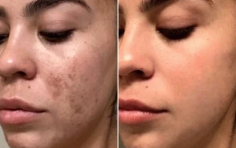 Antes e depois de Fernanda, 29