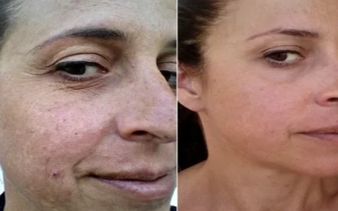 Antes e depois de Jessie, 45
